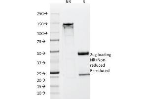 SDS-PAGE Analysis Purified NSE gamma Monoclonal Antibody (SPM347). (ENO2/NSE antibody  (AA 416-433))