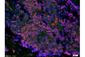 Formalin-fixed and paraffin-embedded human colon labeled with Anti-LI-cadherin Polyclonal Antibody, Unconjugated (ABIN732128) 1:200, overnight at 4°C, The secondary antibody was Goat Anti-Rabbit IgG, Cy3 conjugated used at 1:200 dilution for 40 minutes at 37°C. (LI Cadherin antibody  (AA 101-200))