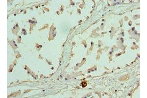 Immunohistochemistry of paraffin-embedded human prostate tissue using ABIN7155474 at dilution of 1:100 (EZH1 antibody  (AA 160-280))