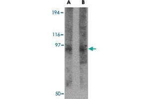 Western blot analysis of TMC8 in rat thymus tissue lysate with TMC8 polyclonal antibody  at (A) 1 and (B) 2 ug/mL . (TMC8 antibody  (N-Term))
