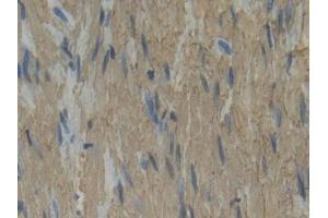 Used in DAB staining on fromalin fixed paraffin- embedded rectum tissue (Plastin 3 antibody  (AA 234-475))