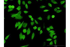 Immunofluorescence of purified MaxPab antibody to PSMD10 on HeLa cell.