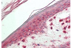 Rabbit Anti-VPS52 antibody Catalog Number: ARP57644 Formalin Fixed Paraffin Embedded Tissue: Human Skin Primary antibody Concentration: 1:100 Secondary Antibody: Donkey anti-Rabbit-Cy3 Secondary Antibody Concentration: 1:200 Magnification: 20x Exposure Time: 0. (VPS52 antibody  (Middle Region))