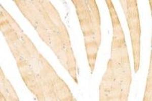 Immunohistochemistry (Paraffin-embedded Sections) (IHC (p)) image for anti-alpha-Actinin Skeletal Muscle (ACTN) antibody (ABIN7073023)