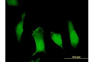 Immunofluorescence of purified MaxPab antibody to APBB1 on HeLa cell.