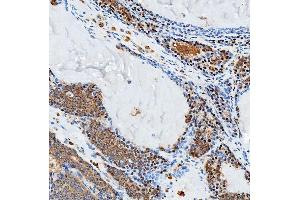 IHC analysis of SFXN3 using anti-SFXN3 antibody (ABIN7601302). (SFXN3 antibody  (AA 32-321))
