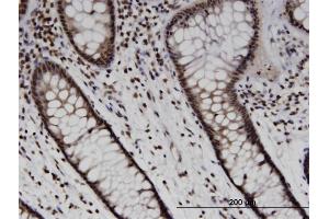 Immunoperoxidase of monoclonal antibody to SOX10 on formalin-fixed paraffin-embedded human colon. (SOX10 antibody  (AA 336-433))