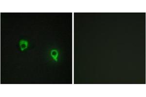 Immunofluorescence analysis of COS7 cells, using AKAP1 antibody. (AKAP1 antibody  (Internal Region))