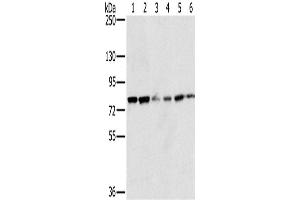 Western Blotting (WB) image for anti-NADPH Oxidase 5 (NOX5) antibody (ABIN2430559) (NOX5 antibody)