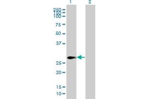 Western Blot analysis of SPANXN2 expression in transfected 293T cell line by SPANXN2 MaxPab polyclonal antibody. (SPANXN2 antibody  (AA 1-180))
