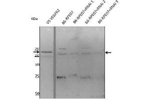 Anti-VEGFR2 antibody at 1/500 dlution, rabbit palyclonal to goat lgG (HRP), at 1/10,000 dilution, (VEGFR2/CD309 antibody  (AA 20-125))