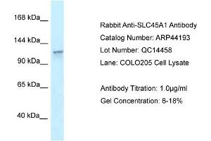 WB Suggested Anti-SLC45A1 Antibody   Titration: 1. (SLC45A1 antibody  (N-Term))