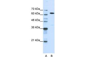 WB Suggested Anti-NXF1 Antibody Titration:  1. (NXF1 antibody  (N-Term))