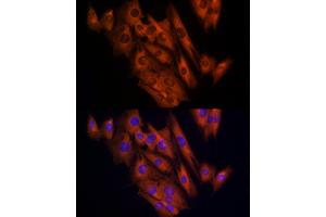 Immunofluorescence analysis of C2C12 cells using CLIC1 Rabbit pAb (ABIN6128983, ABIN6138719, ABIN6138721 and ABIN6217770) at dilution of 1:150 (40x lens).