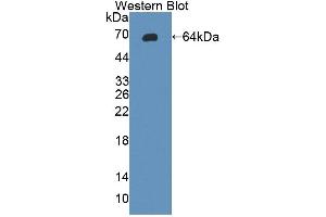Detection of Recombinant gp130, Rat using Polyclonal Antibody to Glycoprotein 130 (gp130) (CD130/gp130 antibody  (AA 26-323))