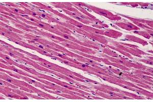 Human Heart: Formalin-Fixed, Paraffin-Embedded (FFPE) (BID antibody  (C-Term))