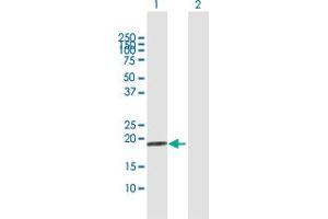 Western Blot analysis of MCAT expression in transfected 293T cell line by MCAT MaxPab polyclonal antibody. (MCAT antibody  (AA 1-180))