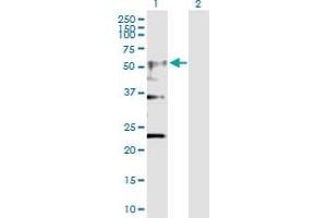 Western Blot analysis of CHRNA4 expression in transfected 293T cell line by CHRNA4 MaxPab polyclonal antibody. (CHRNA4 antibody  (AA 1-451))