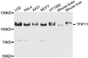 Western blot analysis of extracts of various cell lines, using TFIP11 antibody (ABIN5996279) at 1/1000 dilution. (TFIP11 antibody)