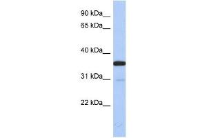ESD antibody used at 1 ug/ml to detect target protein. (Esterase D antibody  (N-Term))