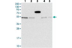 Western blot analysis of Lane 1: RT-4, Lane 2: U-251 MG, Lane 3: Human Plasma, Lane 4: Liver, Lane 5: Tonsil with MSANTD2 polyclonal antibody  at 1:250-1:500 dilution. (MSANTD2 antibody)