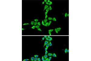 Immunofluorescence analysis of HeLa cells using CES2 Polyclonal Antibody (CES2 antibody)