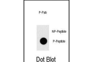 Dot blot analysis of anti-Phospho-TAL1-pT90 Pab (ABIN650830 and ABIN2839799) on nitrocellulose membrane. (TAL1 antibody  (pThr90))
