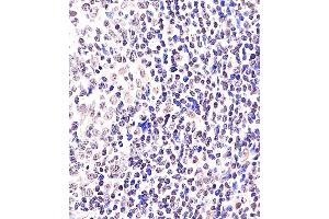 (ABIN6243067 and ABIN6578362) staining BCL6 in Human tonsil tissue sections by Immunohistochemistry (IHC-P - paraformaldehyde-fixed, paraffin-embedded sections). (BCL6 antibody  (AA 364-395))
