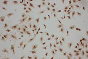 Immunohistochemistry (IHC) image for anti-LIM and SH3 Protein 1 (LASP1) (AA 16-30), (N-Term) antibody (ABIN3044177)