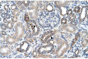 Human kidney (UST antibody  (C-Term))