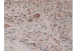 Immunohistochemistry (IHC) image for anti-Enhancer of Zeste Homolog 2 (EZH2) (AA 51-285) antibody (ABIN7436762)