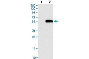 Western blot analysis of Lane 1: Negative control (vector only transfected HEK293T lysate), Lane 2: Over-expression Lysate (Co-expressed with a C-terminal myc-DDK tag (~3. (GALNTL5 antibody)