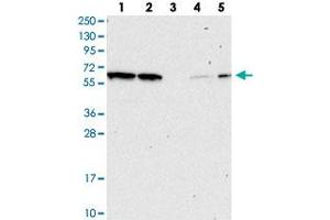 Western blot analysis of Lane 1: RT-4, Lane 2: U-251 MG, Lane 3: Human Plasma, Lane 4: Liver, Lane 5: Tonsil with NAE1 polyclonal antibody .