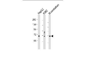 All lanes : Anti-TCF4 Antibody (N-term) at 1:1000 dilution Lane 1: HepG2 whole cell lysate Lane 2: K562 whole cell lysate Lane 3: Mouse cerebellum whole tissue lysate Lysates/proteins at 20 μg per lane.