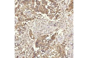 IHC analysis of RBMS1 using anti-RBMS1 antibody (ABIN7601195).