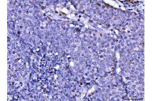 IHC analysis of RAE1 using anti-RAE1 antibody (ABIN7602428). (RAE1 antibody  (AA 76-368))