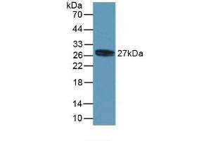 Detection of Recombinant MYL4, Human using Polyclonal Antibody to Myosin Light Chain 4, Alkali, Atrial, Embryonic (MYL4) (MYL4 antibody  (AA 6-191))