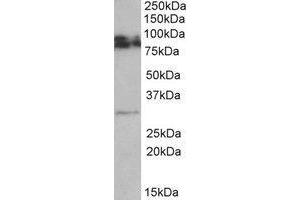 AP23233PU-N GPM6A antibody staining of Rat Brain lysate at 0. (GPM6A antibody  (Internal Region))
