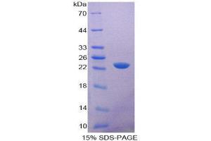 SDS-PAGE (SDS) image for CD6 (CD6) (AA 30-204) protein (His tag) (ABIN2124383) (CD6 Protein (CD6) (AA 30-204) (His tag))