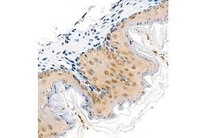 Immunohistochemistry of paraffin embedded mouse stomach using COPS2 (ABIN7073324) at dilution of 1:1400 (400x lens) (CSN2 antibody)