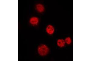 ABIN6275288 staining Hela by IF/ICC. (N4BP1 antibody  (Internal Region))