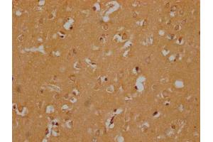 IHC image of ABIN7140024 diluted at 1:300 and staining in paraffin-embedded human brain tissue performed on a Leica BondTM system.