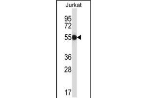 Western blot analysis in Jurkat cell line lysates (35ug/lane). (CNOT2 antibody  (AA 272-301))