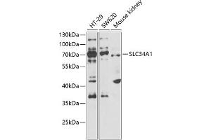 Western blot analysis of extracts of various cell lines, using SLC34 antibody  at 1:1000 dilution.