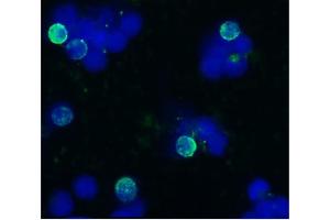 Immunocytochemistry staining of acetone/methanol fixed bovine peripheral blood (lymphocyte-enriched suspension) using anti-bovine CD45R (IVA103), secondary antibody conjugated to FITC (green), DNA stained with DAPI (blue). (CD45 antibody)