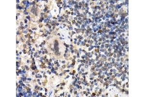 Immunohistochemistry (Paraffin-embedded Sections) (IHC (p)) image for anti-Cell Cycle Checkpoint Protein RAD1 (RAD1) antibody (ABIN7011398)