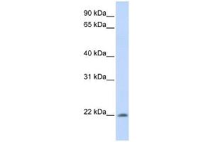 Western Blot showing C2orf28 antibody used at a concentration of 1-2 ug/ml to detect its target protein. (ATRAID antibody  (C-Term))