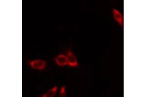 ABIN6274392 staining Hela by IF/ICC. (FASTKD1 antibody  (Internal Region))