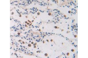 Used in DAB staining on fromalin fixed paraffin- embedded lung tissue (GTF2A2 antibody  (AA 1-109))