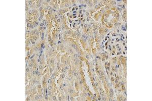 Immunohistochemistry (IHC) image for anti-Histone Deacetylase 6 (HDAC6) (AA 1-200) antibody (ABIN3022457)